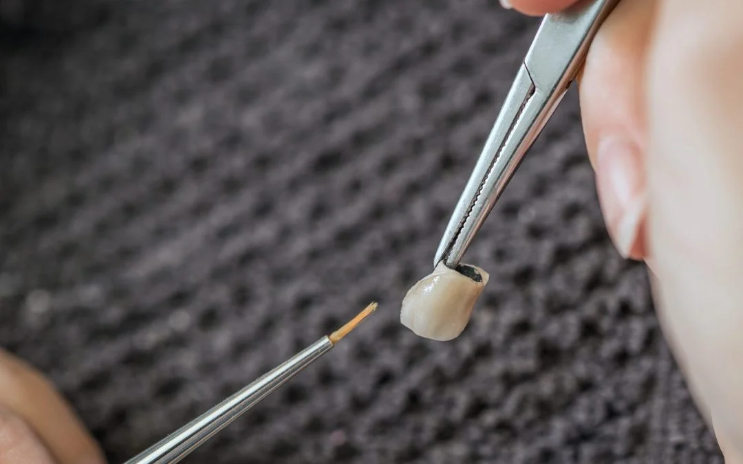 Ask the Right Questions to Find a Suitable Dental Laboratory